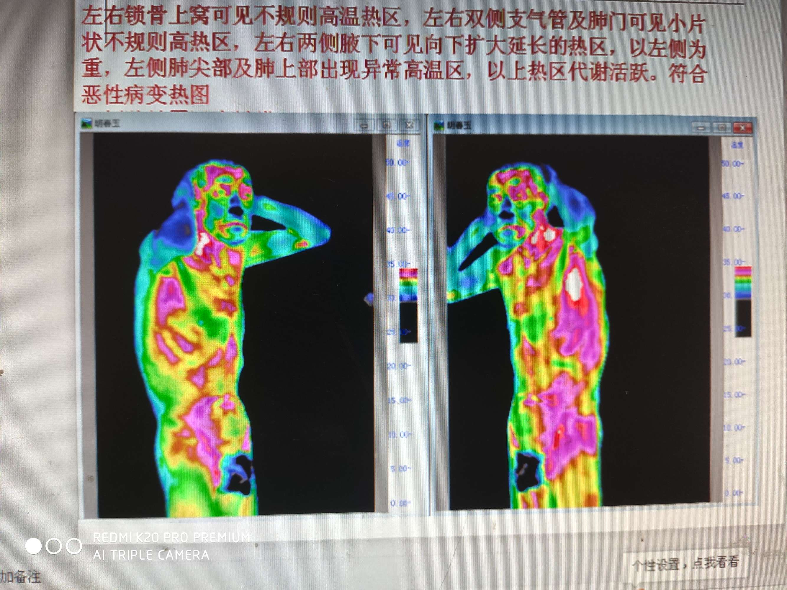 红外热像仪热图报告图片