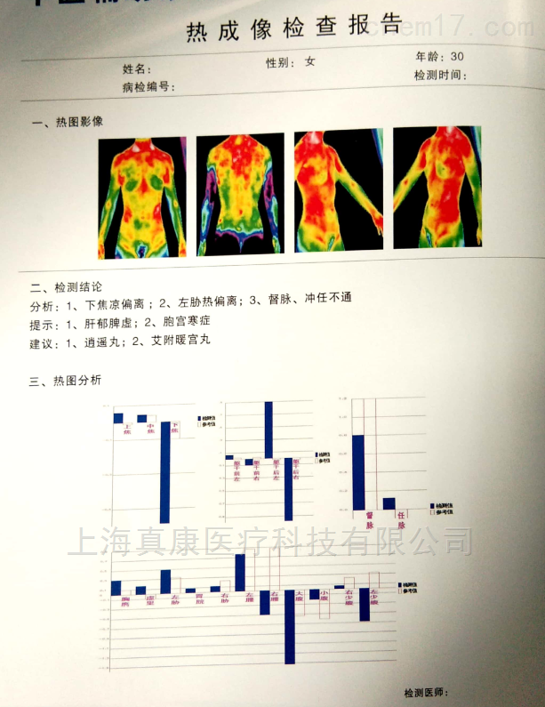 红外热像仪热图报告图片